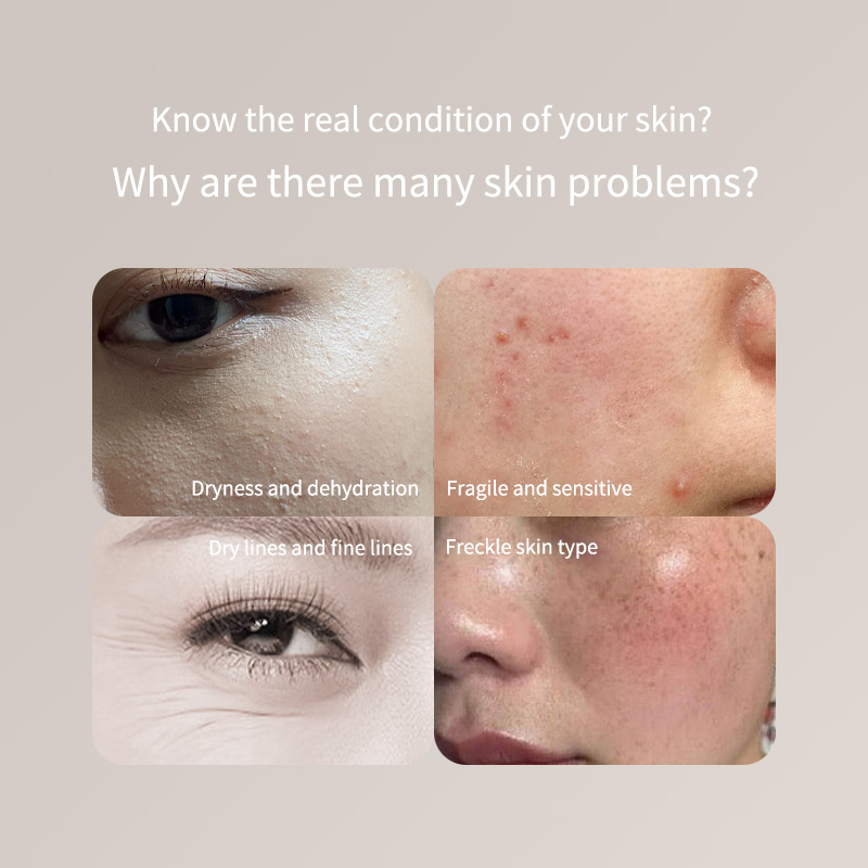 Skincare Only You - Pena Penguji Kulit Portabel - Hanya