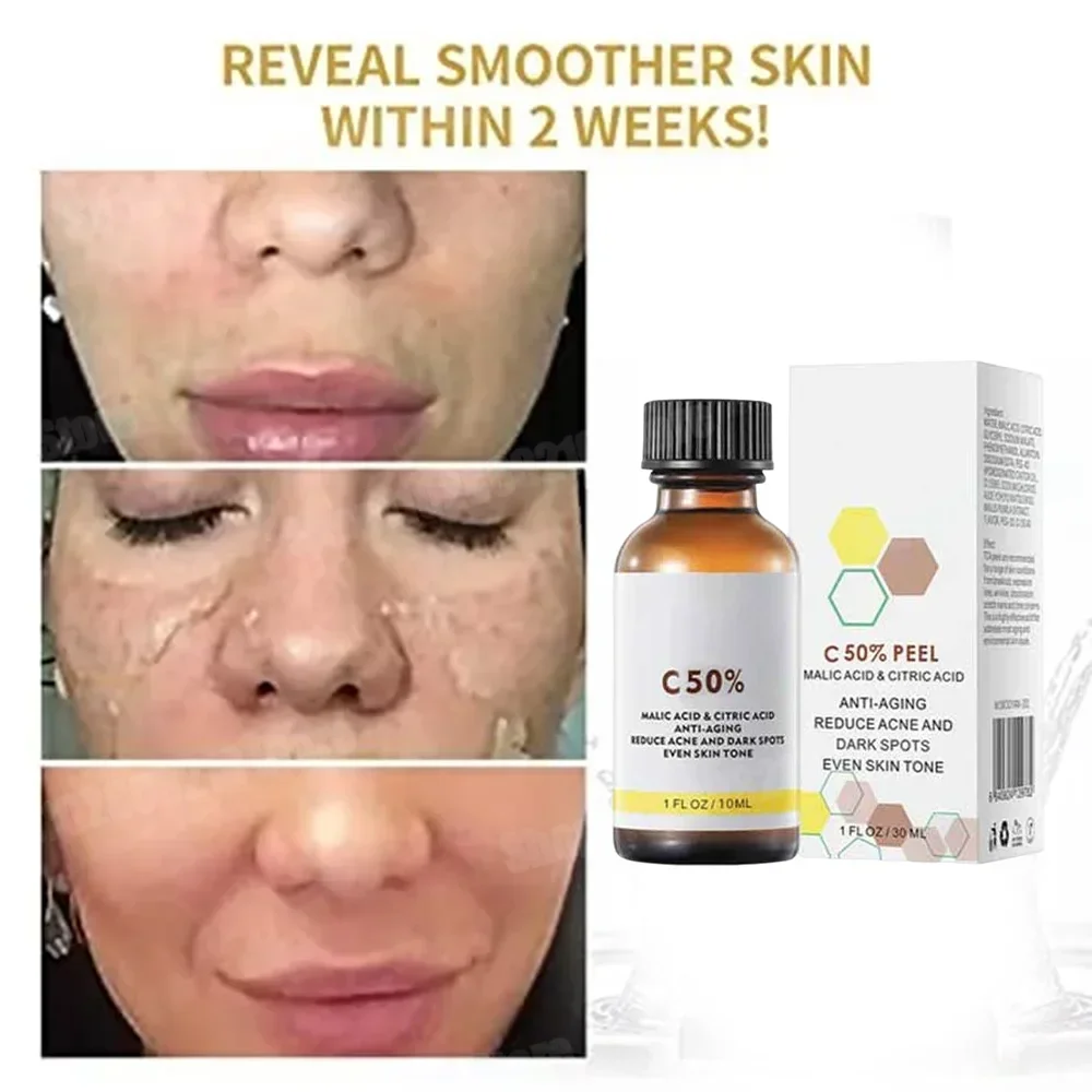 Asam Salisilat Wajah Penetral  - Skincare Salicylic Acid ulasan dan harga